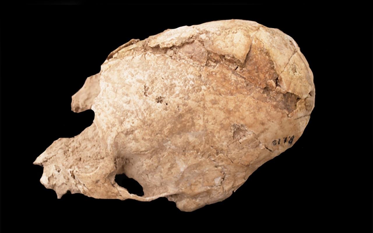 6,200-year-old ‘cone-headed’ skull found in Iran reveals cranial modification and death by blunt force